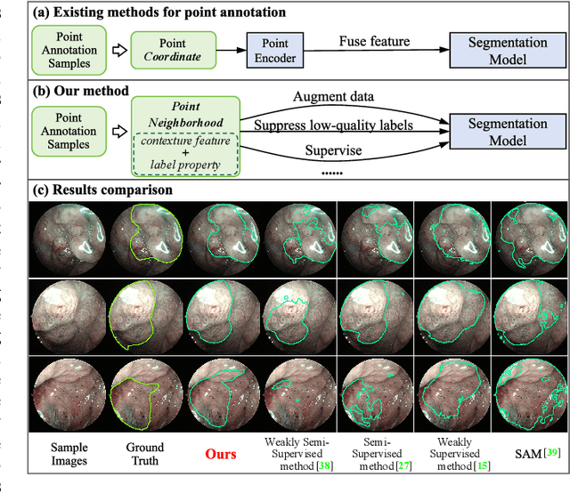 Figure 1 for A Point-Neighborhood Learning Framework for Nasal Endoscope Image Segmentation