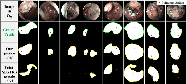 Figure 2 for A Point-Neighborhood Learning Framework for Nasal Endoscope Image Segmentation