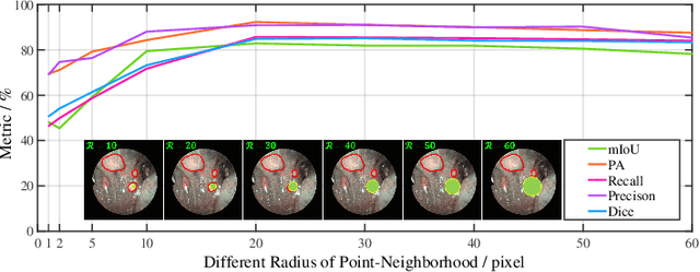 Figure 4 for A Point-Neighborhood Learning Framework for Nasal Endoscope Image Segmentation