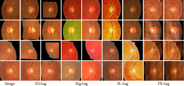 Figure 4 for Devil is in Channels: Contrastive Single Domain Generalization for Medical Image Segmentation