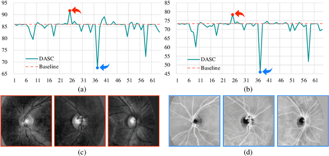 Figure 1 for Devil is in Channels: Contrastive Single Domain Generalization for Medical Image Segmentation
