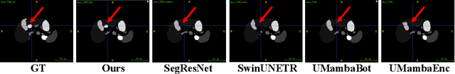 Figure 4 for Large Window-based Mamba UNet for Medical Image Segmentation: Beyond Convolution and Self-attention