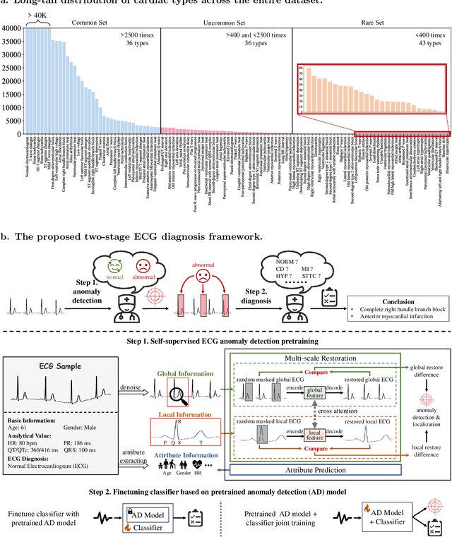 Figure 1 for Self-supervised Anomaly Detection Pretraining Enhances Long-tail ECG Diagnosis