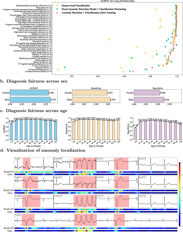Figure 4 for Self-supervised Anomaly Detection Pretraining Enhances Long-tail ECG Diagnosis