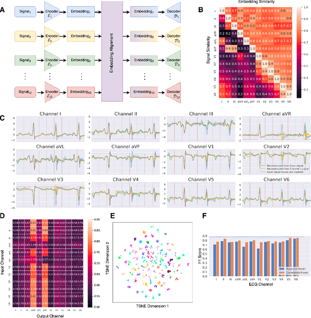 Figure 1 for Modally Reduced Representation Learning of Multi-Lead ECG Signals through Simultaneous Alignment and Reconstruction