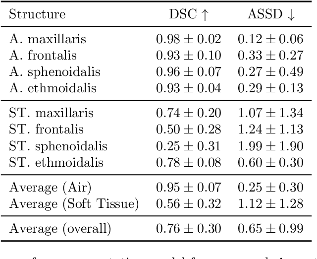 Figure 4 for PARASIDE: An Automatic Paranasal Sinus Segmentation and Structure Analysis Tool for MRI