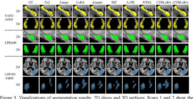 Figure 4 for tCURLoRA: Tensor CUR Decomposition Based Low-Rank Parameter Adaptation for Medical Image Segmentation