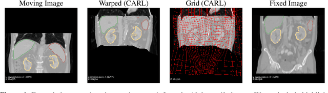 Figure 1 for CARL: A Framework for Equivariant Image Registration