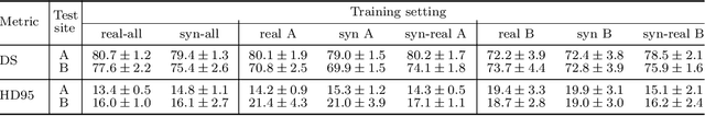 Figure 4 for Hyperparameter-Free Medical Image Synthesis for Sharing Data and Improving Site-Specific Segmentation