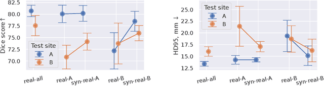 Figure 3 for Hyperparameter-Free Medical Image Synthesis for Sharing Data and Improving Site-Specific Segmentation