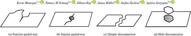 Figure 3 for Generalizing Shape-from-Template to Topological Changes