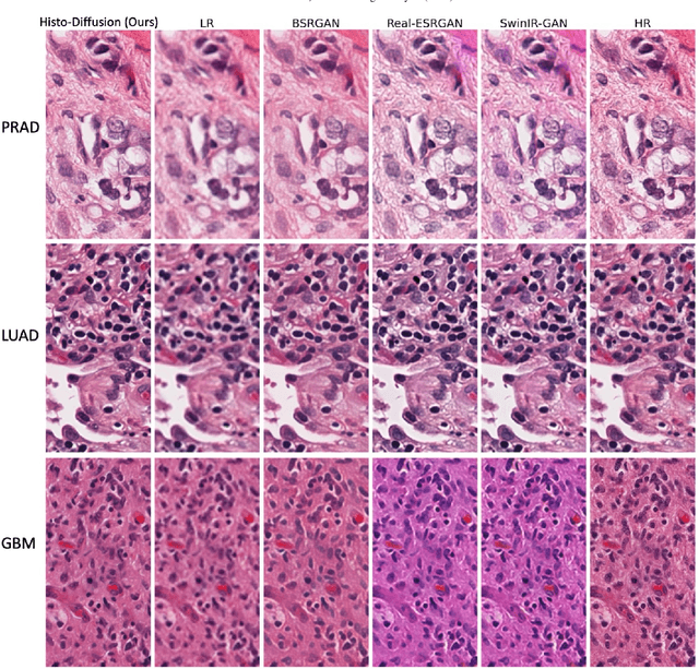 Figure 1 for Histo-Diffusion: A Diffusion Super-Resolution Method for Digital Pathology with Comprehensive Quality Assessment