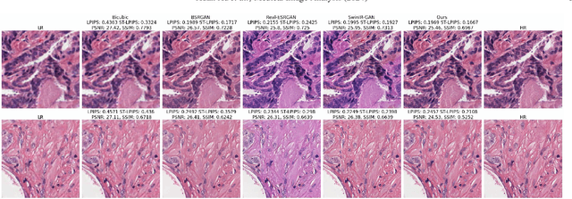 Figure 3 for Histo-Diffusion: A Diffusion Super-Resolution Method for Digital Pathology with Comprehensive Quality Assessment