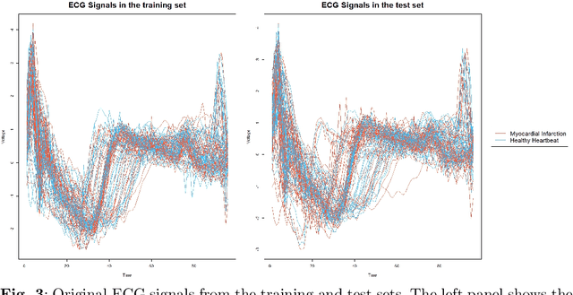 Figure 3 for Demystifying Functional Random Forests: Novel Explainability Tools for Model Transparency in High-Dimensional Spaces
