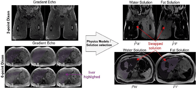 Figure 1 for MAGO-SP: Detection and Correction of Water-Fat Swaps in Magnitude-Only VIBE MRI