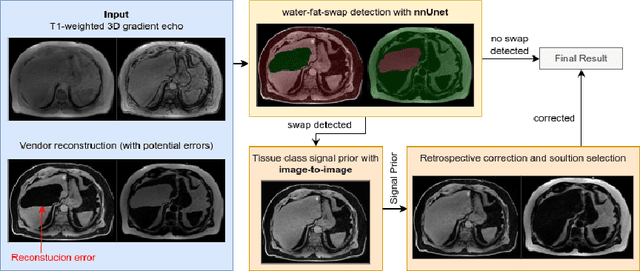 Figure 3 for MAGO-SP: Detection and Correction of Water-Fat Swaps in Magnitude-Only VIBE MRI
