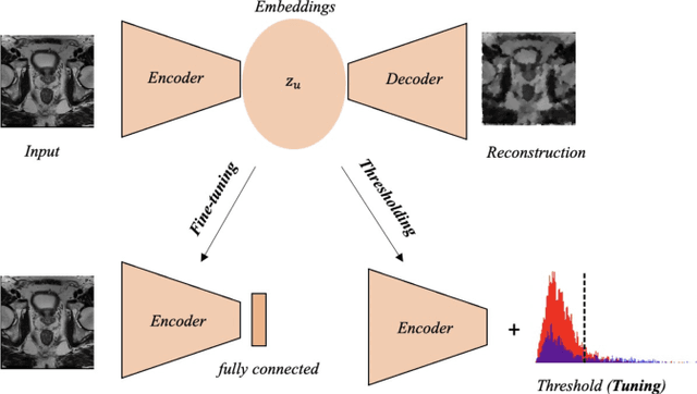 Figure 4 for Out-of-distribution multi-view auto-encoders for prostate cancer lesion detection