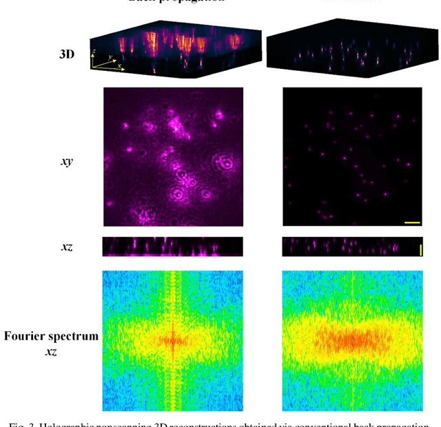 Figure 3 for Three-dimensional neural network driving self-interference digital holography enables high-fidelity, non-scanning volumetric fluorescence microscopy