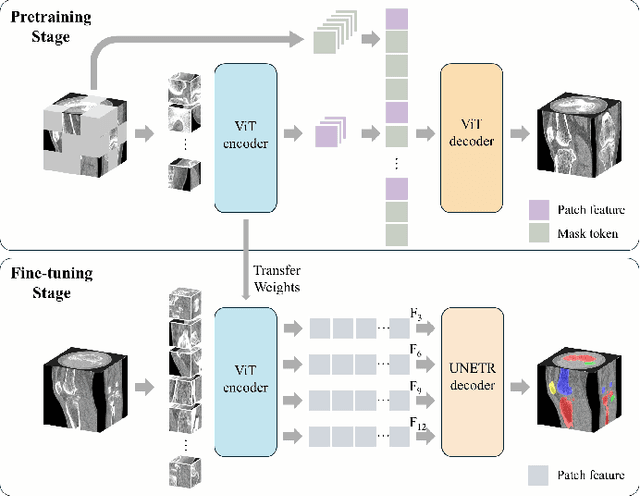 Figure 2 for Learning Generalizable Features for Tibial Plateau Fracture Segmentation Using Masked Autoencoder and Limited Annotations