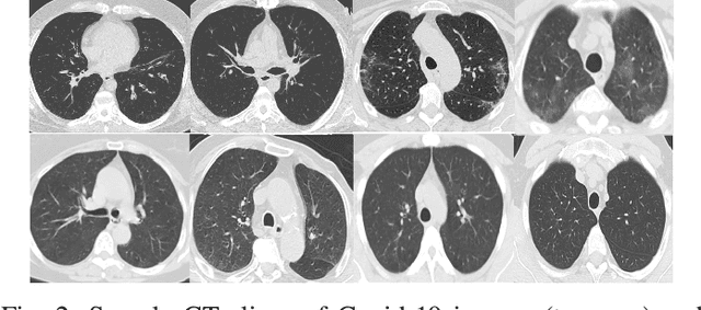 Figure 2 for A Comparative Study of Federated Learning Models for COVID-19 Detection