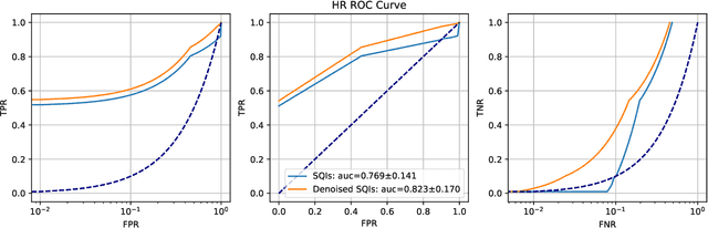Figure 4 for Signal Quality Auditing for Time-series Data