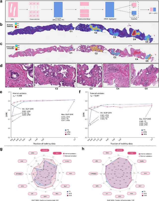 Figure 2 for Foundation Models -- A Panacea for Artificial Intelligence in Pathology?