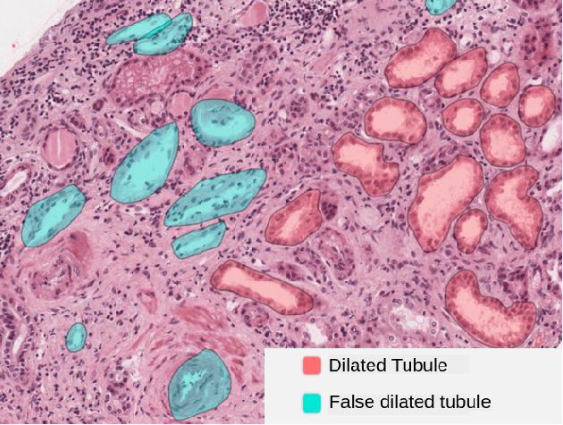 Figure 2 for Deep ContourFlow: Advancing Active Contours with Deep Learning