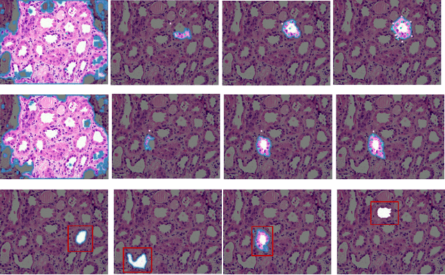 Figure 4 for Deep ContourFlow: Advancing Active Contours with Deep Learning