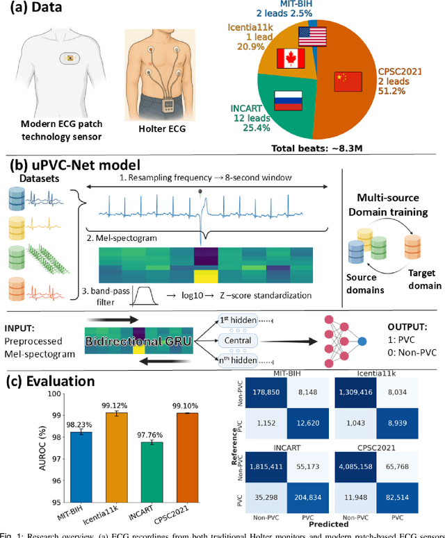 Figure 1 for uPVC-Net: A Universal Premature Ventricular Contraction Detection Deep Learning Algorithm