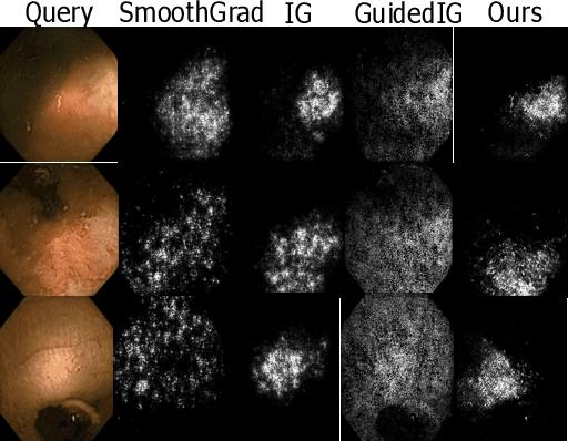Figure 4 for This changes to that : Combining causal and non-causal explanations to generate disease progression in capsule endoscopy