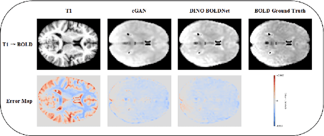 Figure 2 for DINO-BOLDNet: A DINOv3-Guided Multi-Slice Attention Network for T1-to-BOLD Generation