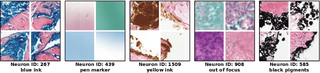 Figure 3 for Prototype-Based Multiple Instance Learning for Gigapixel Whole Slide Image Classification