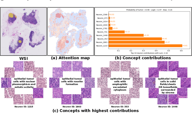 Figure 4 for Prototype-Based Multiple Instance Learning for Gigapixel Whole Slide Image Classification