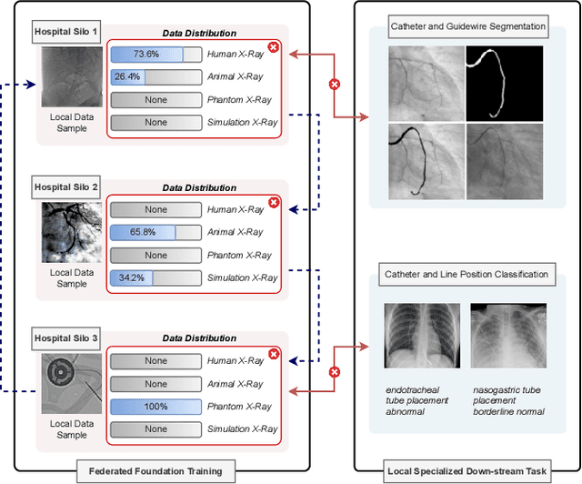Figure 2 for FedEFM: Federated Endovascular Foundation Model with Unseen Data