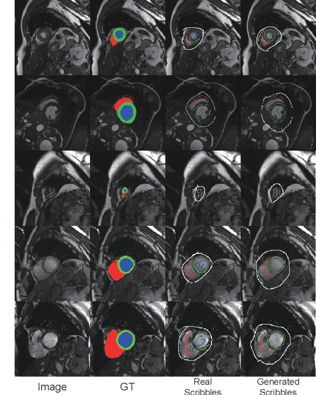 Figure 3 for Volumetric Medical Image Segmentation via Scribble Annotations and Shape Priors