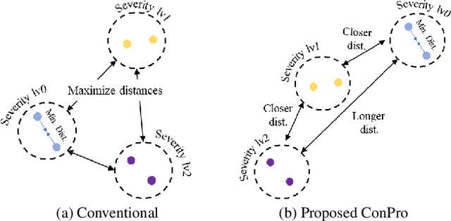 Figure 1 for ConPro: Learning Severity Representation for Medical Images using Contrastive Learning and Preference Optimization