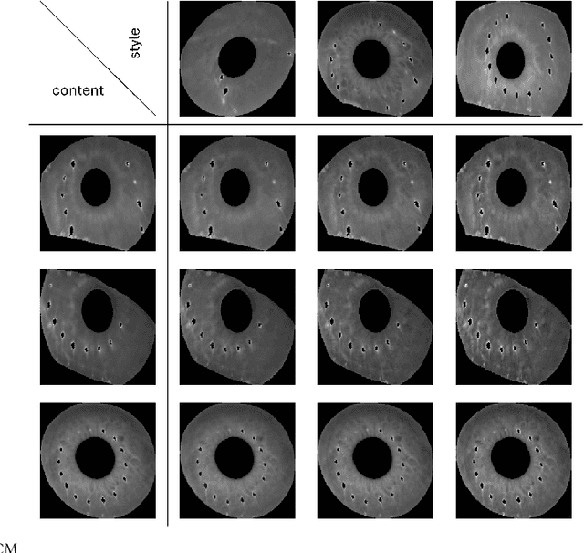 Figure 2 for Iris Style Transfer: Enhancing Iris Recognition with Style Features and Privacy Preservation through Neural Style Transfer