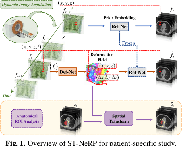 Figure 1 for ST-NeRP: Spatial-Temporal Neural Representation Learning with Prior Embedding for Patient-specific Imaging Study