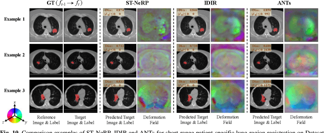 Figure 2 for ST-NeRP: Spatial-Temporal Neural Representation Learning with Prior Embedding for Patient-specific Imaging Study