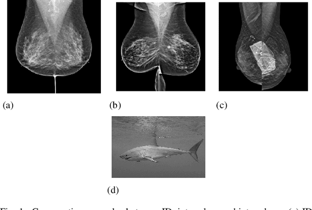 Figure 1 for Unsupervised Hybrid framework for ANomaly Detection (HAND) -- applied to Screening Mammogram