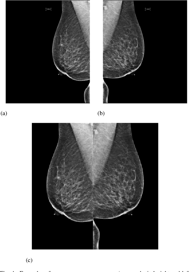 Figure 4 for Unsupervised Hybrid framework for ANomaly Detection (HAND) -- applied to Screening Mammogram