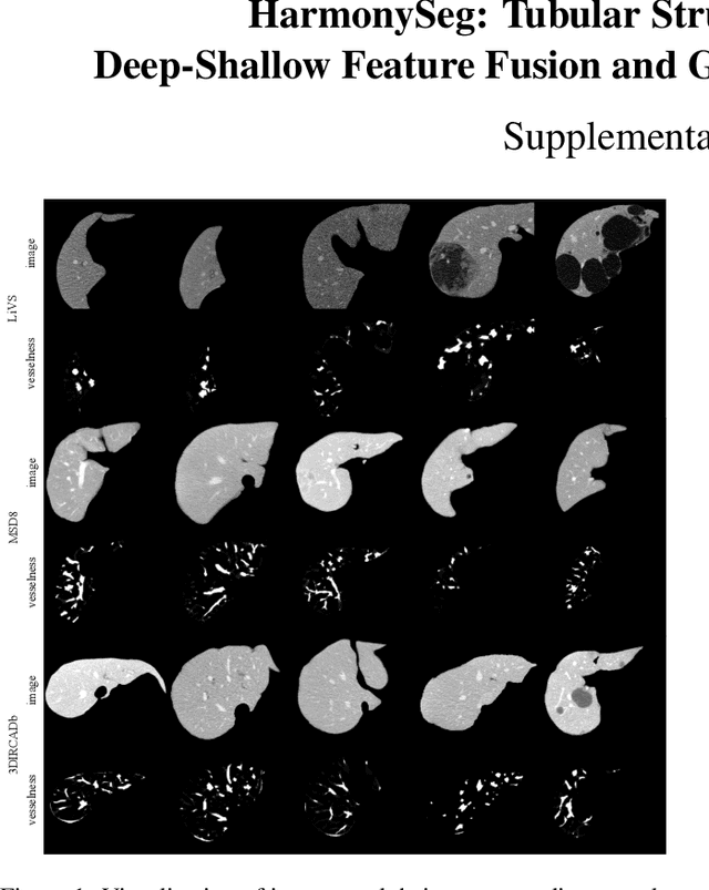 Figure 2 for HarmonySeg: Tubular Structure Segmentation with Deep-Shallow Feature Fusion and Growth-Suppression Balanced Loss