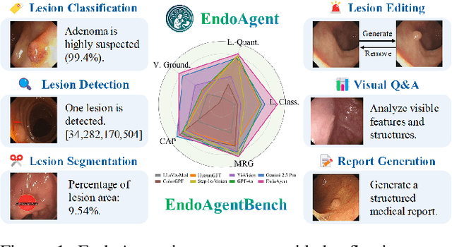 Figure 1 for EndoAgent: A Memory-Guided Reflective Agent for Intelligent Endoscopic Vision-to-Decision Reasoning