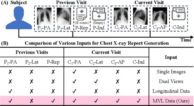 Figure 1 for Enhanced Contrastive Learning with Multi-view Longitudinal Data for Chest X-ray Report Generation