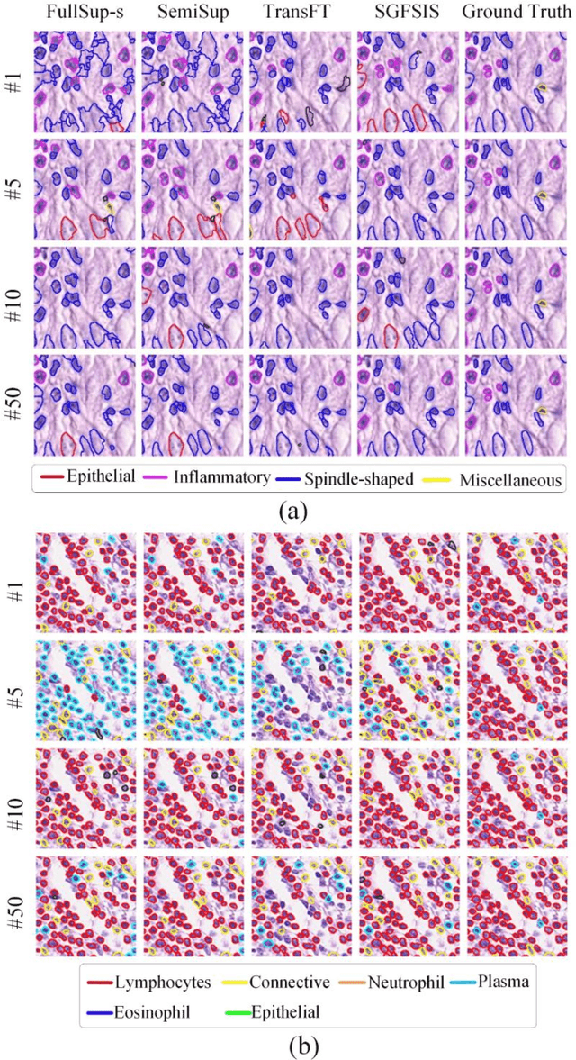 Figure 4 for Few-Shot Learning for Annotation-Efficient Nucleus Instance Segmentation