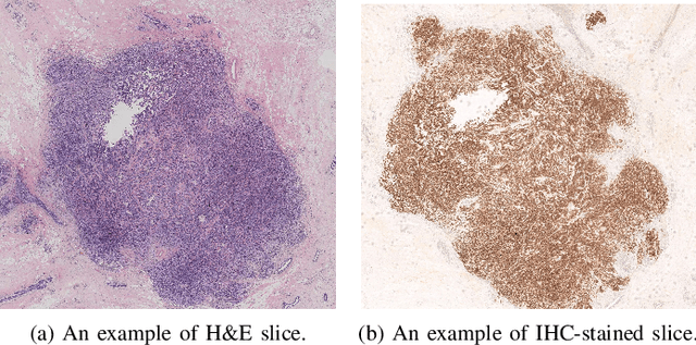 Figure 1 for Breast Cancer Immunohistochemical Image Generation: a Benchmark Dataset and Challenge Review