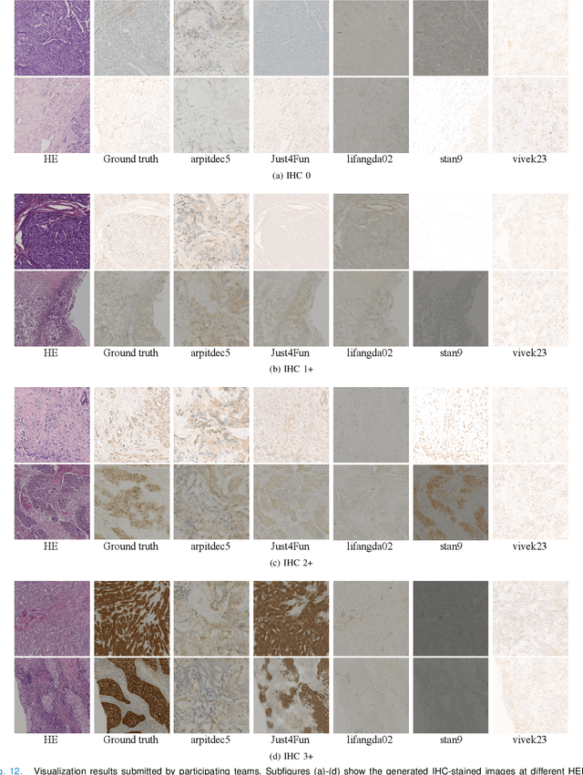 Figure 4 for Breast Cancer Immunohistochemical Image Generation: a Benchmark Dataset and Challenge Review