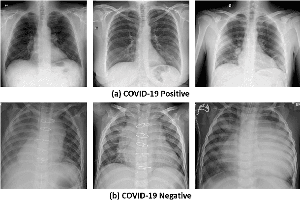 Figure 2 for Evaluating Convolutional Neural Networks for COVID-19 classification in chest X-ray images