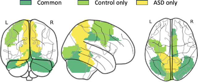 Figure 4 for Causal Modeling of fMRI Time-series for Interpretable Autism Spectrum Disorder Classification