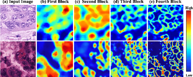 Figure 2 for SEINE: Structure Encoding and Interaction Network for Nuclei Instance Segmentation